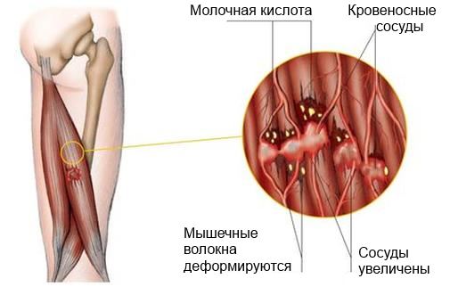 Боль при массаже: причины